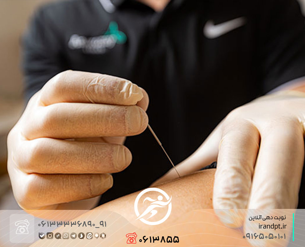 علاج تقلص العضلات بالنيدلينغ